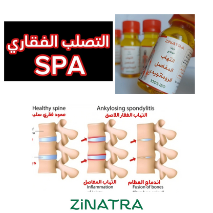 لالتهاب المفاصل والأوتار ZiNATRA  زيت التدليك