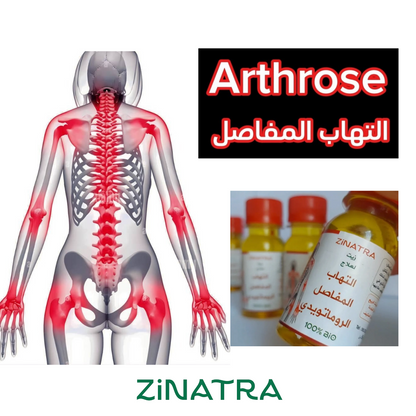 لالتهاب المفاصل والأوتار ZiNATRA  زيت التدليك