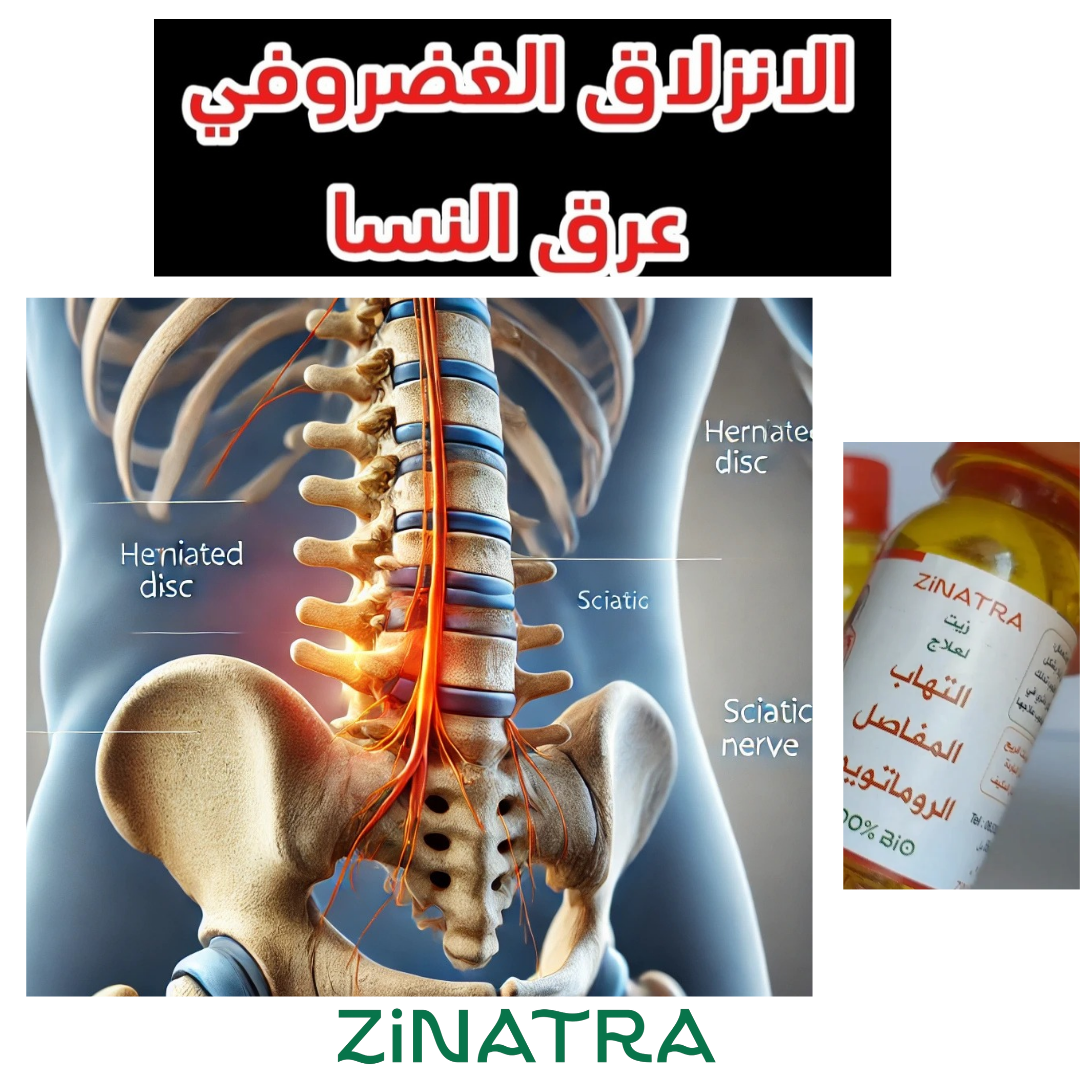 لالتهاب المفاصل والأوتار ZiNATRA  زيت التدليك