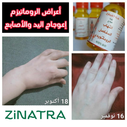 لالتهاب المفاصل والأوتار ZiNATRA  زيت التدليك